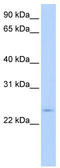 SAP Domain Containing Ribonucleoprotein antibody, TA339777, Origene, Western Blot image 