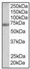 Formin-binding protein 1 antibody, AP23820PU-N, Origene, Western Blot image 