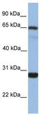 Mediator of RNA polymerase II transcription subunit 4 antibody, TA339711, Origene, Western Blot image 