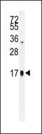  antibody, 56-122, ProSci, Western Blot image 
