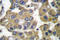Stromelysin-3 antibody, LS-C176121, Lifespan Biosciences, Immunohistochemistry paraffin image 