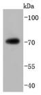 FUS RNA Binding Protein antibody, NBP2-67913, Novus Biologicals, Western Blot image 