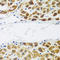 N(Alpha)-Acetyltransferase 60, NatF Catalytic Subunit antibody, LS-C349102, Lifespan Biosciences, Immunohistochemistry paraffin image 