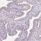 Leucine Rich Repeat Containing 23 antibody, PA5-58095, Invitrogen Antibodies, Immunohistochemistry frozen image 