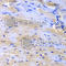 Cullin 2 antibody, A5308, ABclonal Technology, Immunohistochemistry paraffin image 