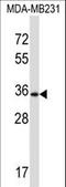 Deltex E3 Ubiquitin Ligase 3 antibody, LS-C167558, Lifespan Biosciences, Western Blot image 