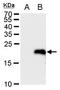 LIM Domain Only 4 antibody, GTX129616, GeneTex, Western Blot image 