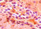 Aspartate aminotransferase, cytoplasmic antibody, A52800-100, Epigentek, Immunohistochemistry paraffin image 