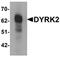 Dual specificity tyrosine-phosphorylation-regulated kinase 2 antibody, orb75595, Biorbyt, Western Blot image 