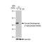 Pyruvate Dehydrogenase E1 Alpha 1 Subunit antibody, GTX03213, GeneTex, Western Blot image 