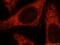 Mitochondrial Ribosomal Protein L10 antibody, 16652-1-AP, Proteintech Group, Immunofluorescence image 
