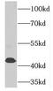Phosphate Cytidylyltransferase 2, Ethanolamine antibody, FNab06233, FineTest, Western Blot image 