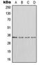 DHEA-ST antibody, MBS821685, MyBioSource, Western Blot image 