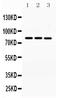 CDK-activating kinase assembly factor MAT1 antibody, PB9614, Boster Biological Technology, Western Blot image 