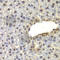 SPT20 Homolog, SAGA Complex Component antibody, A7374, ABclonal Technology, Immunohistochemistry paraffin image 