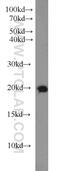 RAB18, Member RAS Oncogene Family antibody, 11304-1-AP, Proteintech Group, Western Blot image 
