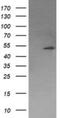 Protein Phosphatase, Mg2+/Mn2+ Dependent 1B antibody, NBP2-45383, Novus Biologicals, Western Blot image 