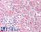 Egl-9 Family Hypoxia Inducible Factor 1 antibody, LS-C83713, Lifespan Biosciences, Immunohistochemistry paraffin image 
