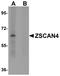 Zinc finger and SCAN domain-containing protein 4 antibody, A13391, Boster Biological Technology, Western Blot image 