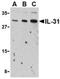 Interleukin 31 antibody, NBP1-77256, Novus Biologicals, Western Blot image 