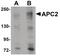 APC Regulator Of WNT Signaling Pathway 2 antibody, PA5-20944, Invitrogen Antibodies, Western Blot image 