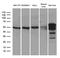 Thioredoxin Reductase 1 antibody, LS-C798917, Lifespan Biosciences, Western Blot image 