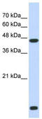 Histone deacetylase 8 antibody, TA337234, Origene, Western Blot image 