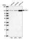 Splicing Factor 3a Subunit 1 antibody, HPA030083, Atlas Antibodies, Western Blot image 