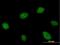 Pre-mRNA-splicing factor CWC22 homolog antibody, H00057703-B01P, Novus Biologicals, Immunocytochemistry image 