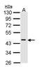 DNA Fragmentation Factor Subunit Alpha antibody, GTX113416, GeneTex, Western Blot image 