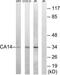 Carbonic Anhydrase 14 antibody, TA315264, Origene, Western Blot image 