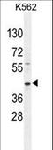 Rab effector Noc2 antibody, LS-C162695, Lifespan Biosciences, Western Blot image 