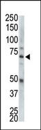 Serine/Threonine Kinase 33 antibody, AP14426PU-N, Origene, Western Blot image 