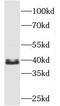 Tubulin Folding Cofactor C antibody, FNab08518, FineTest, Western Blot image 
