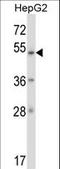 Zinc Finger Protein 207 antibody, LS-C160836, Lifespan Biosciences, Western Blot image 