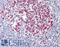 Heterogeneous nuclear ribonucleoprotein A/B antibody, LS-B10179, Lifespan Biosciences, Immunohistochemistry paraffin image 