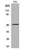 Cholinergic Receptor Nicotinic Alpha 10 Subunit antibody, orb159819, Biorbyt, Western Blot image 