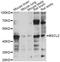 BSCL2 Lipid Droplet Biogenesis Associated, Seipin antibody, LS-C749582, Lifespan Biosciences, Western Blot image 