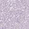 Mitotic Spindle Positioning antibody, HPA049511, Atlas Antibodies, Immunohistochemistry paraffin image 