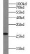 Vesicle Transport Through Interaction With T-SNAREs 1B antibody, FNab09463, FineTest, Western Blot image 