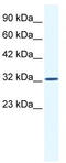 Small Nuclear RNA Activating Complex Polypeptide 2 antibody, TA330157, Origene, Western Blot image 