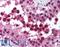 Cullin 9 antibody, LS-B1386, Lifespan Biosciences, Immunohistochemistry paraffin image 