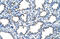 Epithelial membrane protein 2 antibody, ARP41470_T100, Aviva Systems Biology, Immunohistochemistry paraffin image 