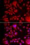 Bleomycin Hydrolase antibody, LS-C334781, Lifespan Biosciences, Immunofluorescence image 