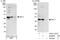 MCL1 Apoptosis Regulator, BCL2 Family Member antibody, A302-715A, Bethyl Labs, Western Blot image 