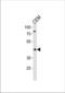 Fatty acid desaturase 2 antibody, TA324808, Origene, Western Blot image 