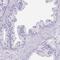 Dickkopf Like Acrosomal Protein 1 antibody, PA5-61463, Invitrogen Antibodies, Immunohistochemistry frozen image 