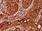 Elongator Complex Protein 1 antibody, CSB-PA011571LA01HU, Cusabio, Immunohistochemistry paraffin image 