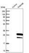 Ras-related protein Rab-39B antibody, NBP1-85819, Novus Biologicals, Western Blot image 