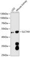 Solute Carrier Family 7 Member 9 antibody, GTX66127, GeneTex, Western Blot image 